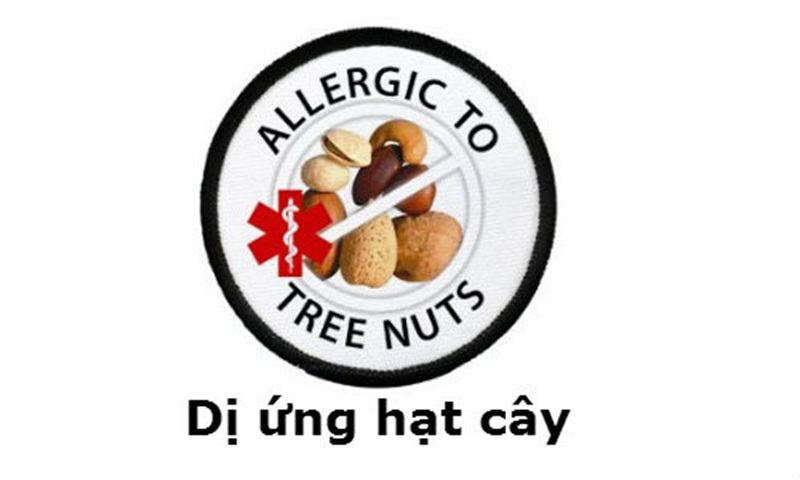 Người có tiền sử dị ứng hạt cây